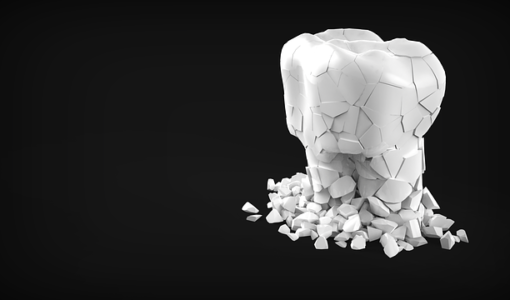 Implanturi dentare Bucuresti